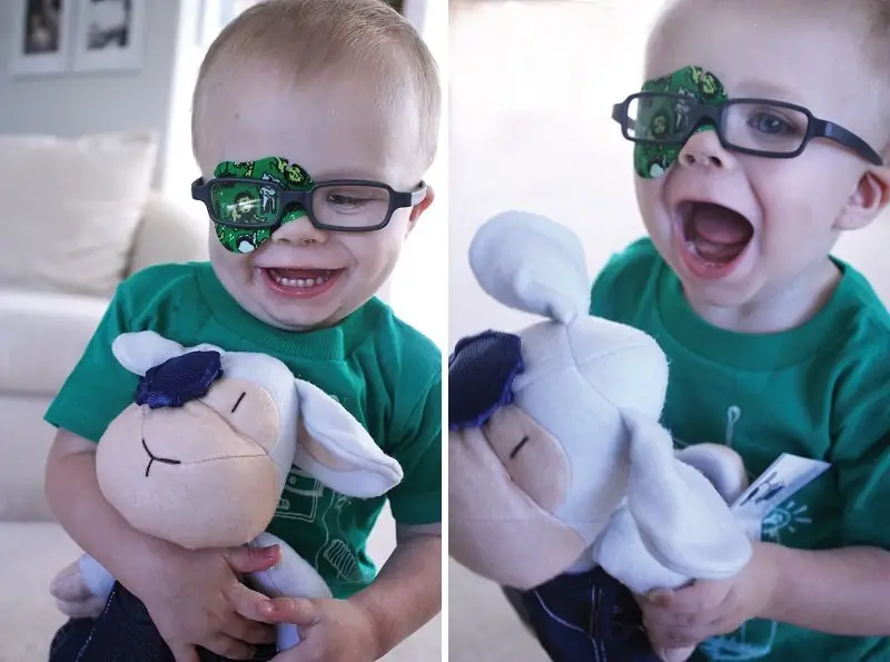 Strabismus in children