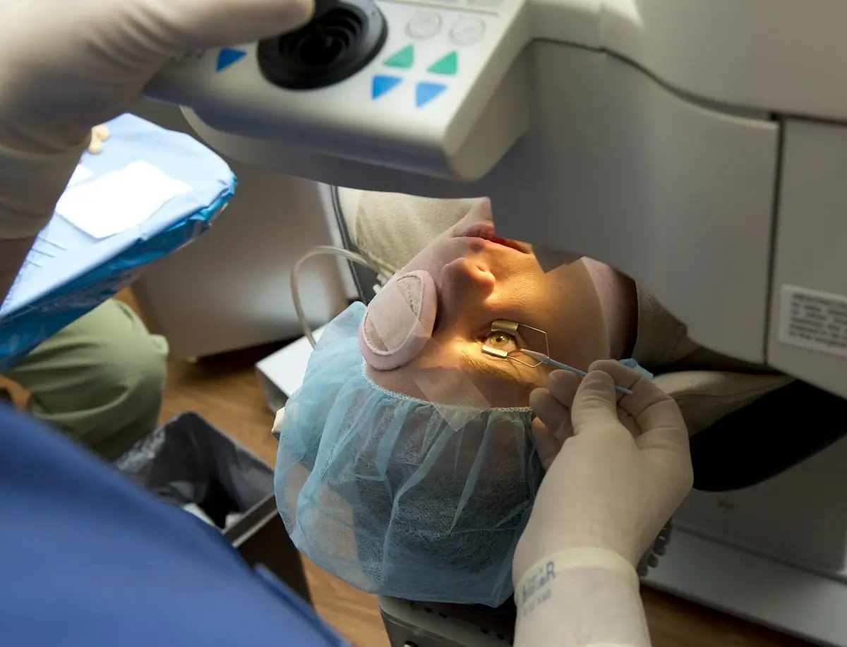 How will I feel during laser dioptre removal?